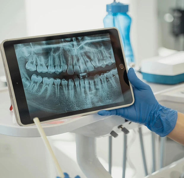 Dentist reviewing dental X-ray on iPad, checking tooth alignment issues.