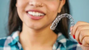 What Is Invisalign aligner What Is Invisalign aligner