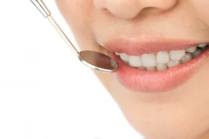 Tooth Enamel Defects CLARINDA