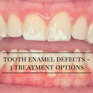 Tooth Enamel Defects – 3 Treatment Options