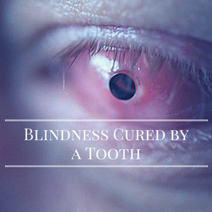 Blindness Cured by a Tooth