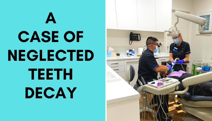 case of tooth decay